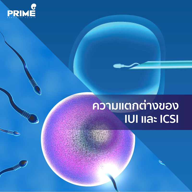 iui success story