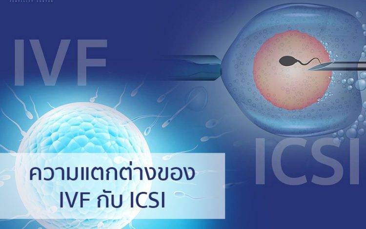 IVF,ICSI,试管婴儿,单精子注射