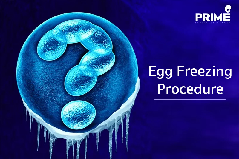 Egg Freezing Procedure | Prime Fertility Center | Do IVF/ICSI