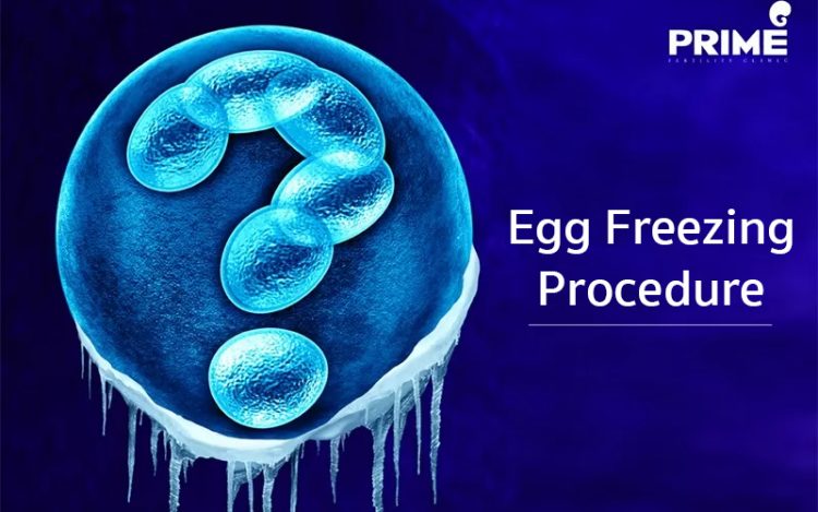 Egg freezing, ฝากไข่แช่แข็ง, 卵子冷冻