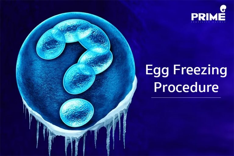Egg Freezing Procedure Prime Fertility Center Do Ivficsi
