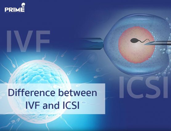 Difference Between Ivf And Icsi Prime Fertility Center