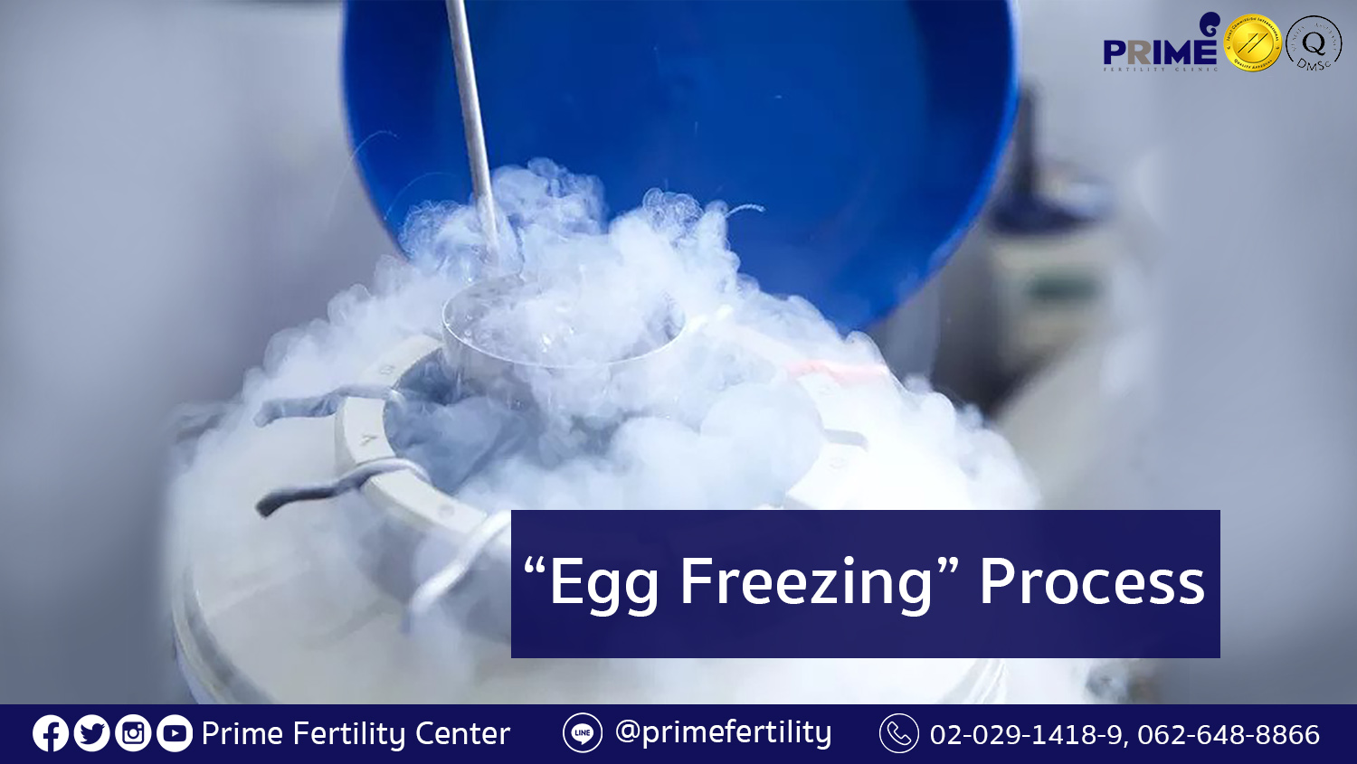 Egg Freezing Process | IVF/ICSI | Prime Fertility Clinic