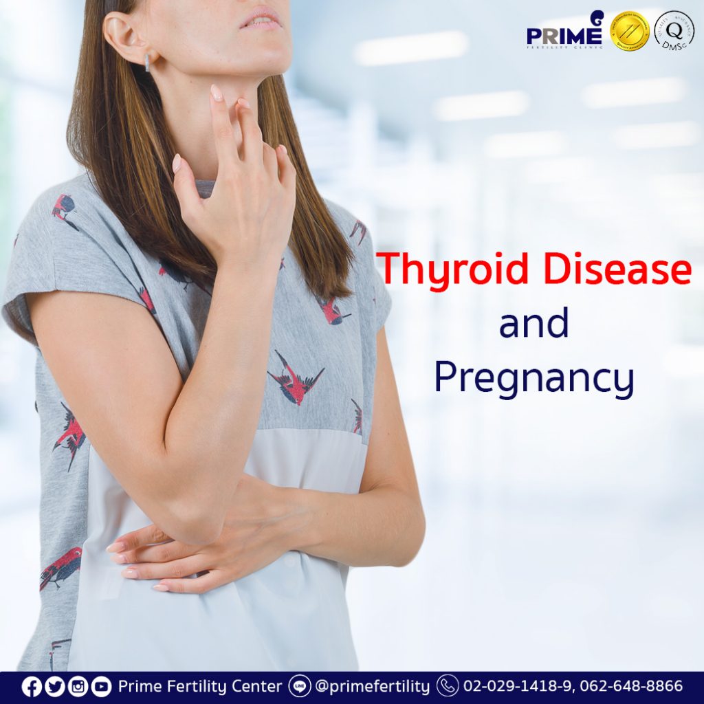 Thyroid Disease and Pregnancy | Prime Fertility Center | IVF/ICSI/IUI