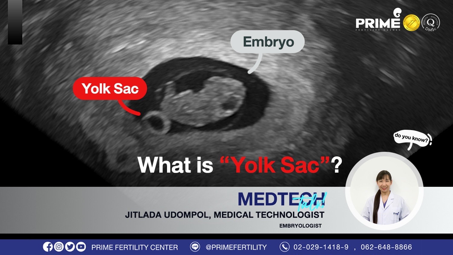 What Is Yolk Sac Prime Fertility Clinic