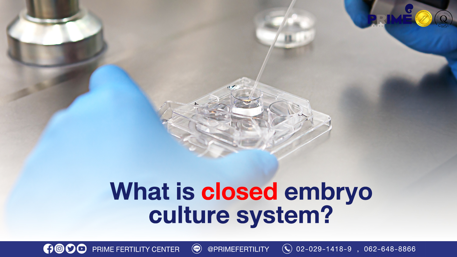 What is closed embryo culture system? | Prime Fertility Clinic