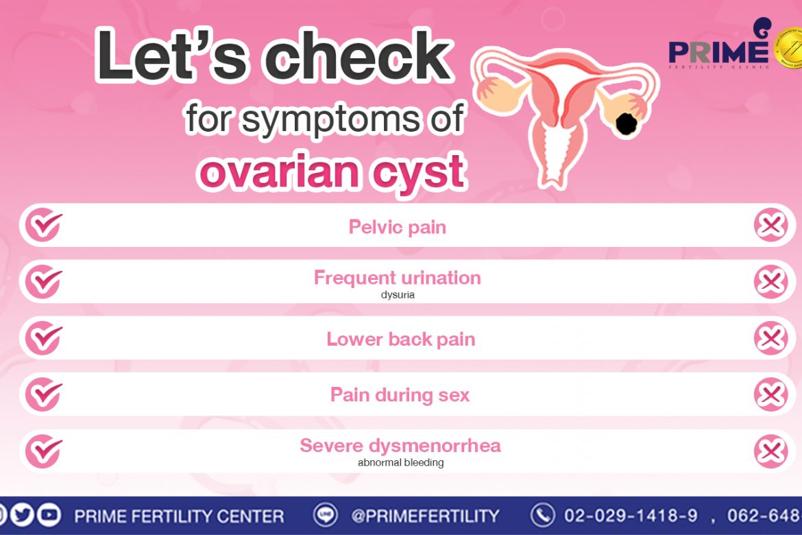 Let's check for symptoms of ovarian cyst   fertility clinic bangkok