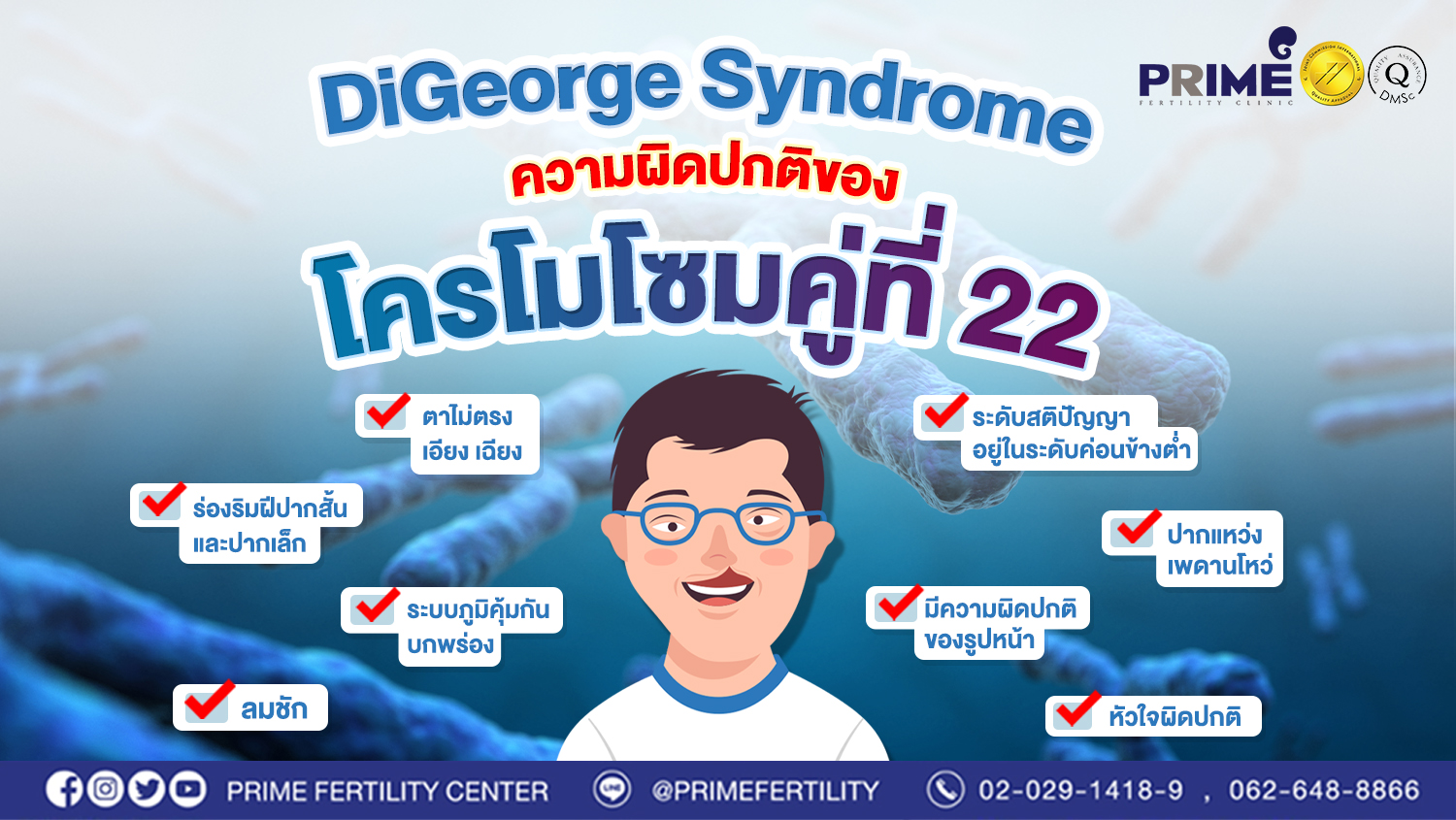 DiGeorge syndrome ความผิดปกติของโครโมโซมคู่ที่ 22