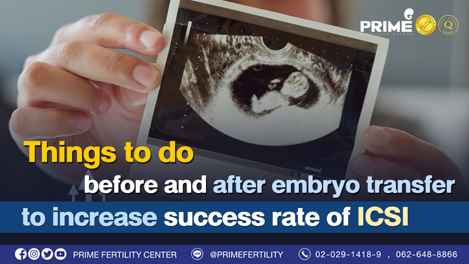 Things to do before and after embryo transfer to increase success rate of ICSI