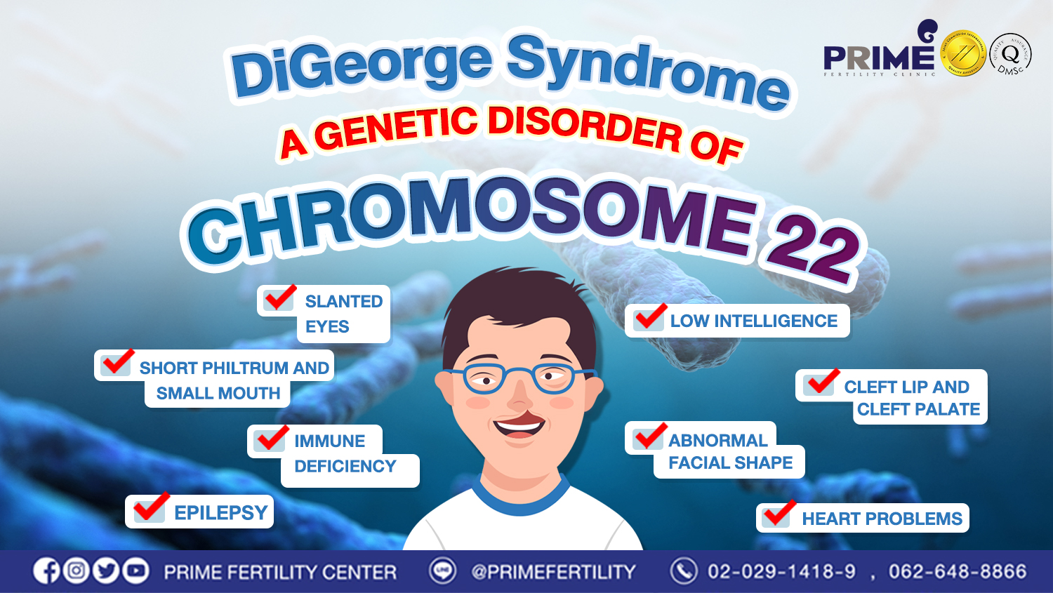 DiGeorge syndrome, a genetic disorder of chromosome 22
