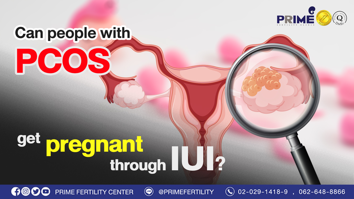 Can people with PCOS get pregnant through IUI?